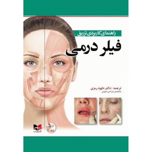 راهنمای کاربردی تزریق فیلر درمی-رمزی/آبادیس طب