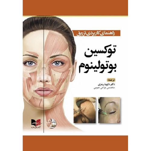 راهنمای کاربردی تزریق توکسین بوتولینوم-رمزی/آبادیس طب